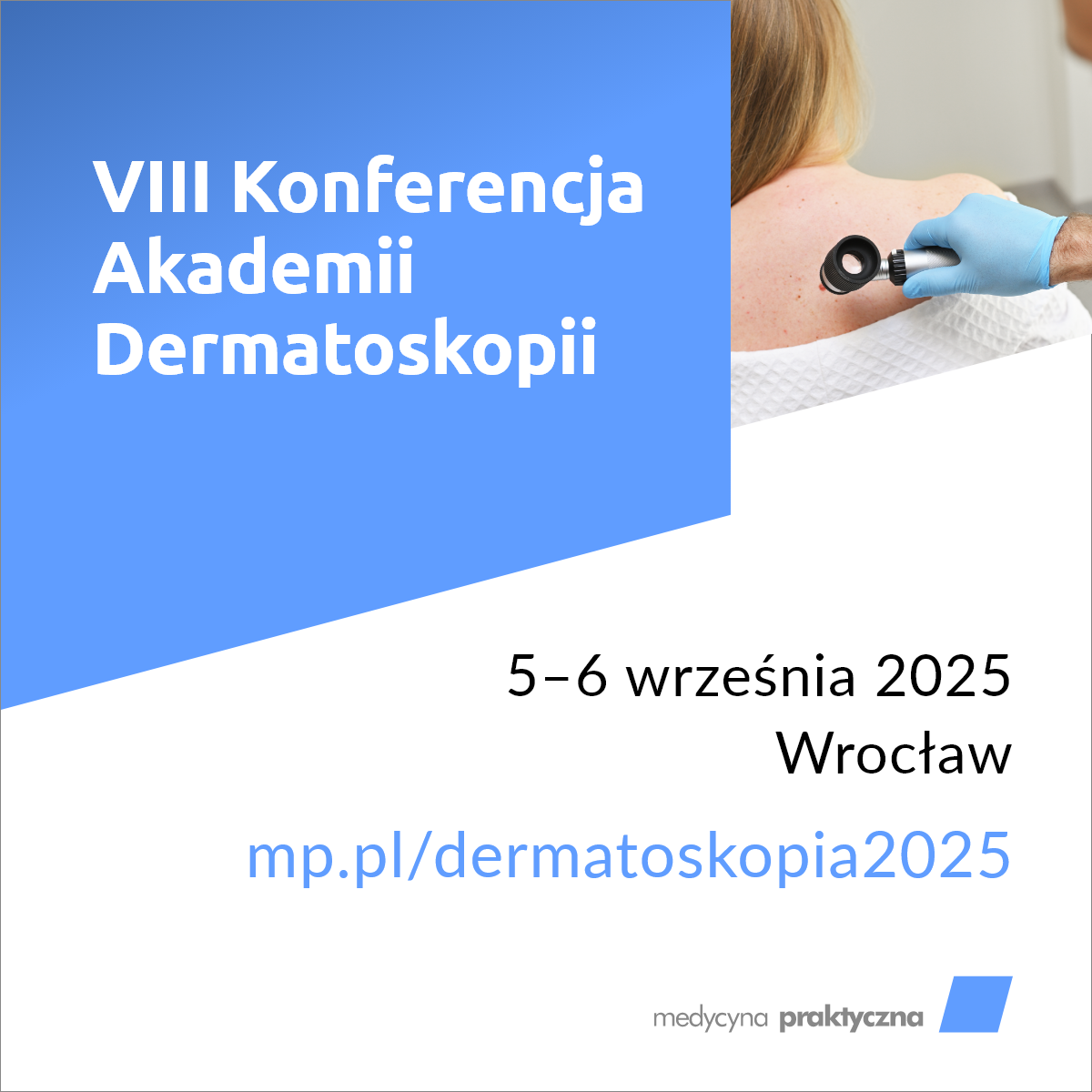 DERMATOSKOPIA
